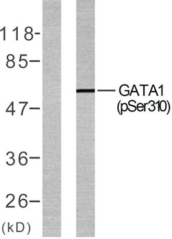 GATA-1 (phospho Ser310) rabbit pAb