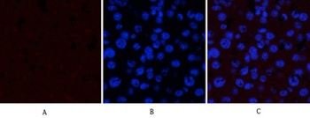 GSK3alpha/beta (phospho-Tyr279/216) antibody