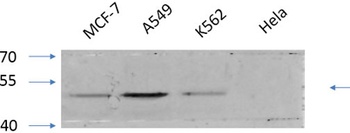 GSK3alpha/beta (phospho-Tyr279/216) antibody