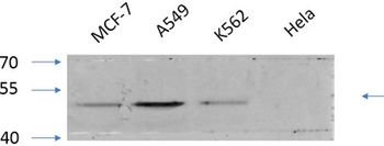 GSK3α/β (phospho Tyr279/216) rabbit pAb