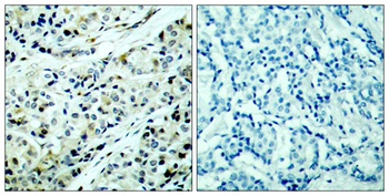 HDAC5 (phospho Ser498) rabbit pAb