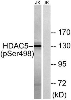HDAC5 (phospho Ser498) rabbit pAb
