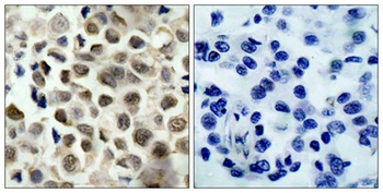 HDAC8 (phospho Ser39) rabbit pAb