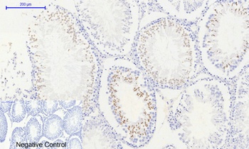 Histone H2A.X (phospho-Ser139) antibody