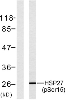HSP27 (phospho-Ser15) antibody