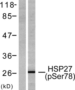 HSP27 (phospho-Ser78) antibody