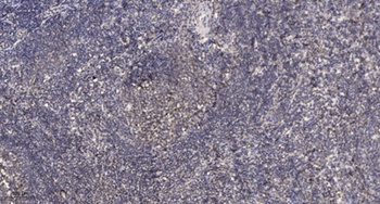HSP27 (phospho Ser78) rabbit pAb