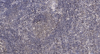 HSP27 (phospho-Ser78) antibody