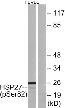 HSP27 (phospho Ser82) rabbit pAb