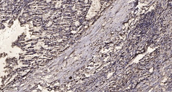 HSP27 (phospho Ser82) rabbit pAb
