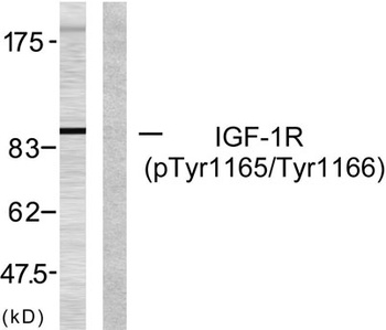IGF-IR (phospho-Tyr1165/Y1166) antibody