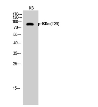 IKKα (phospho Thr23) rabbit pAb