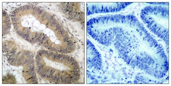 IKKα (phospho Thr23) rabbit pAb