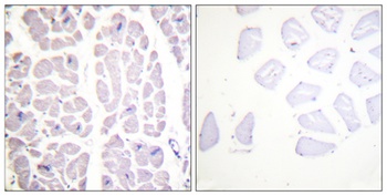 IKKalpha/beta (phospho-Ser180/181) antibody