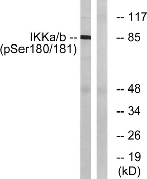 IKKalpha/beta (phospho-Ser180/181) antibody