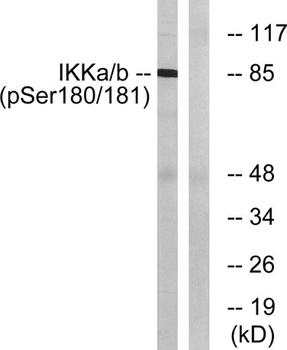 IKKα/β (phospho Ser180/181) rabbit pAb
