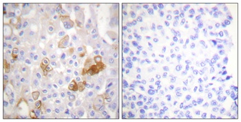 Integrin β1 (phospho Thr788) rabbit pAb
