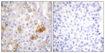 Integrin beta1 (phospho-Thr788) antibody