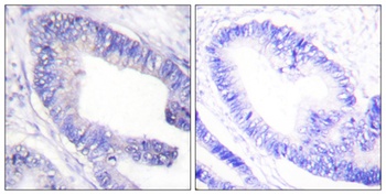 IRS-1 (phospho Ser1101) rabbit pAb