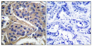IRS-1 (phospho Ser307) rabbit pAb