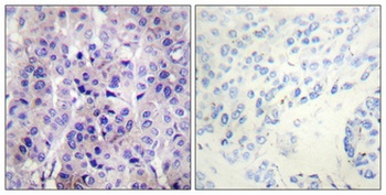 IRS-1 (phospho-Ser307) antibody