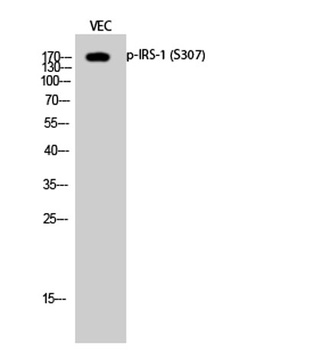 IRS-1 (phospho-Ser307) antibody