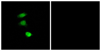 IRS-1 (phospho Ser307) rabbit pAb