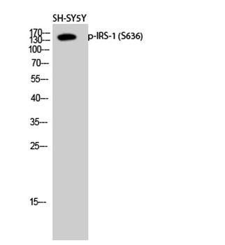 IRS-1 (phospho-Ser636) antibody