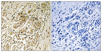 IRS-1 (phospho-Ser639) antibody