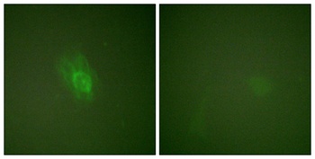 I kappa B-beta (phospho-Ser23) antibody