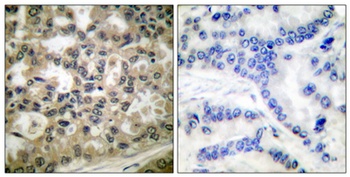 IκB-β (phospho Ser23) rabbit pAb