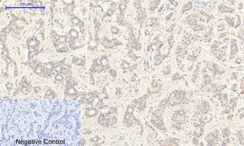 JAK2 (phospho-Tyr1007) antibody