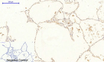 JAK2 (phospho-Tyr1007) antibody