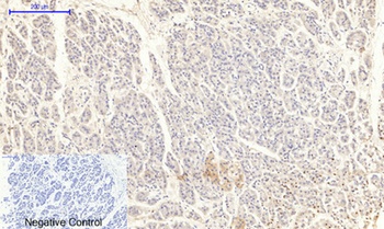 JAK2 (phospho-Tyr1007) antibody