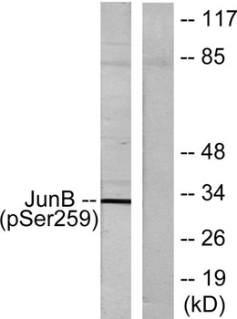 Jun B (phospho-Ser259) antibody