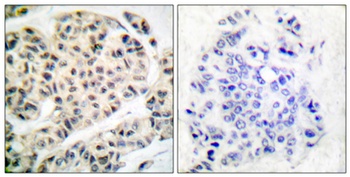 MEF-2 (phospho Thr319) rabbit pAb