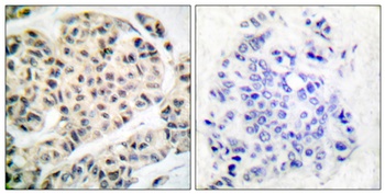 MEF-2 (phospho-Thr319) antibody