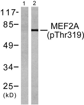 MEF-2 (phospho-Thr319) antibody