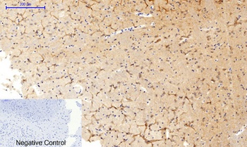 MEK-1/2 (phospho Ser218/222) rabbit pAb