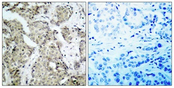 MEK-3 (phospho Ser218) rabbit pAb