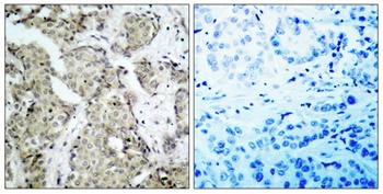 MEK-3 (phospho-Ser218) antibody