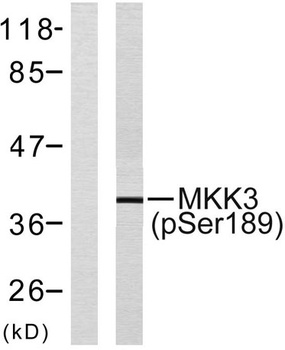 MEK-3 (phospho-Ser218) antibody