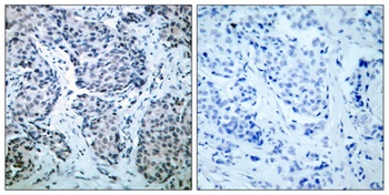MEK-4 (phospho Thr261) rabbit pAb