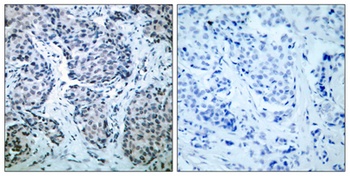 MEK-4 (phospho-Thr261) antibody