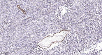 Met (phospho Tyr1349) rabbit pAb