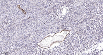 Met (phospho-Tyr1349) antibody