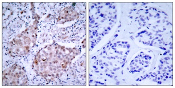 Neu (phospho-Tyr1221/Y1222) antibody