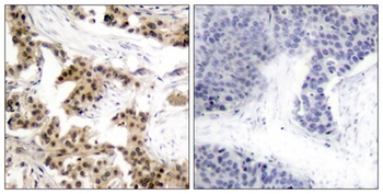 NFκB-p105 (phospho Ser893) rabbit pAb