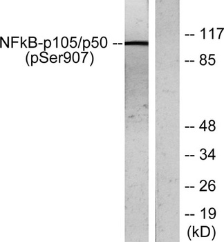 NFκB-p105 (phospho Ser907) rabbit pAb