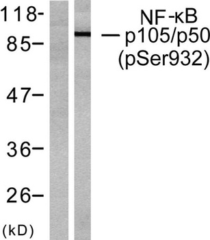 NF kappa B-p105 (phospho-Ser932) antibody